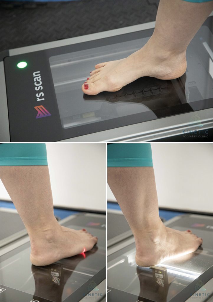 3D+Foot+Scan+-+Kinetic+Podiatry+Clinic+-+2