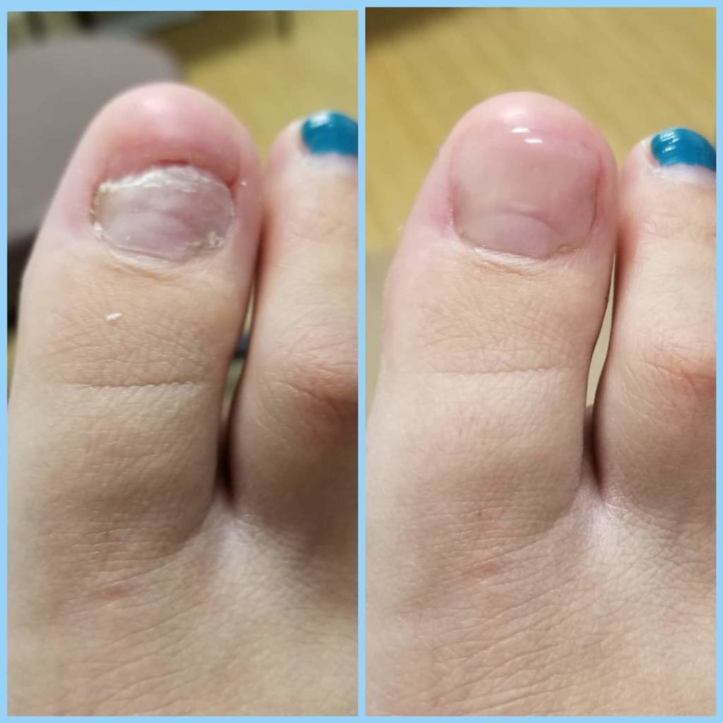 Before-and-after-patient-8-1024×1024